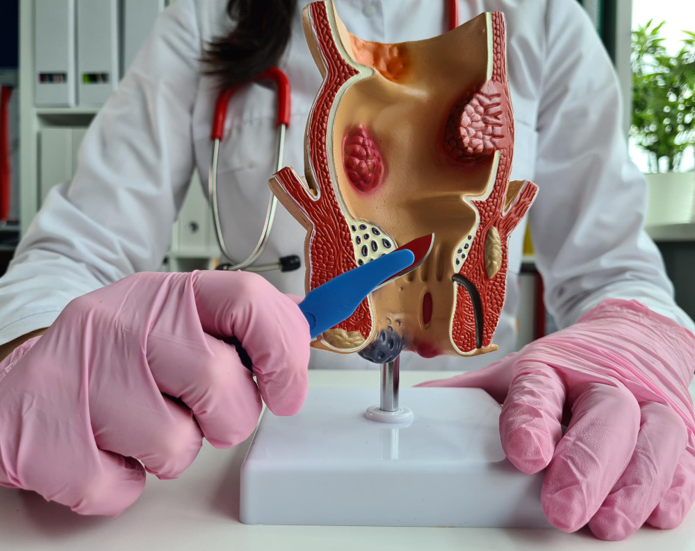 Laser Piles Treatment Hospital in Pune: Advance... main image