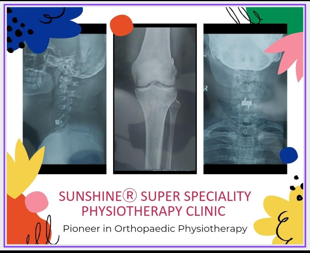 Orthopedic physiotherapy is a specialized branc... main image