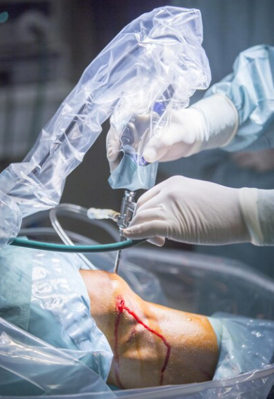Orthopedics and Joint Replacement Surgery in Nashi... main image