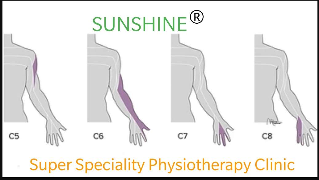 Physiotherapy is a key treatment option for managi... main image