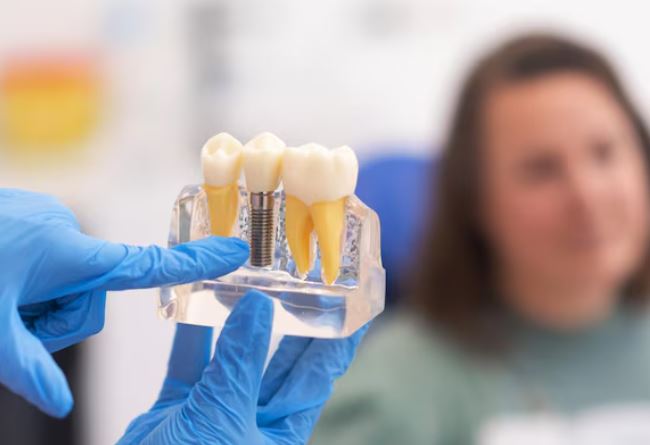 Implants Services in Nagpur for Permanent Dental S... main image