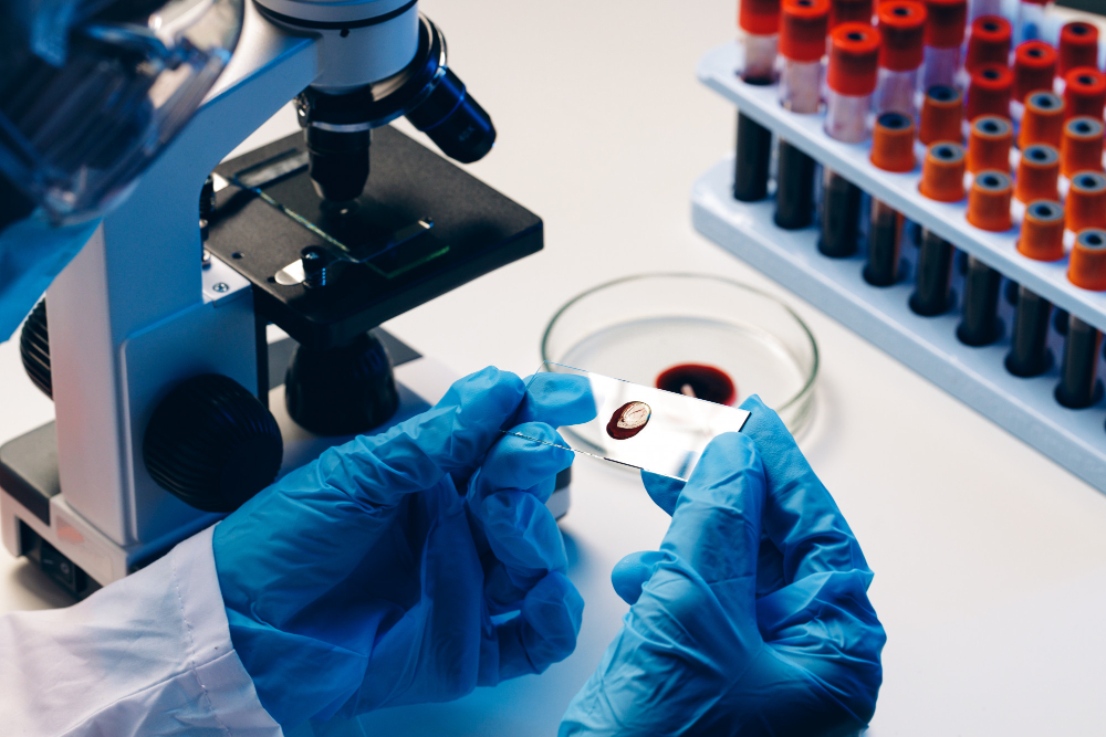 Best Pathology Lab in Pune – Reliable and Fast ... main image