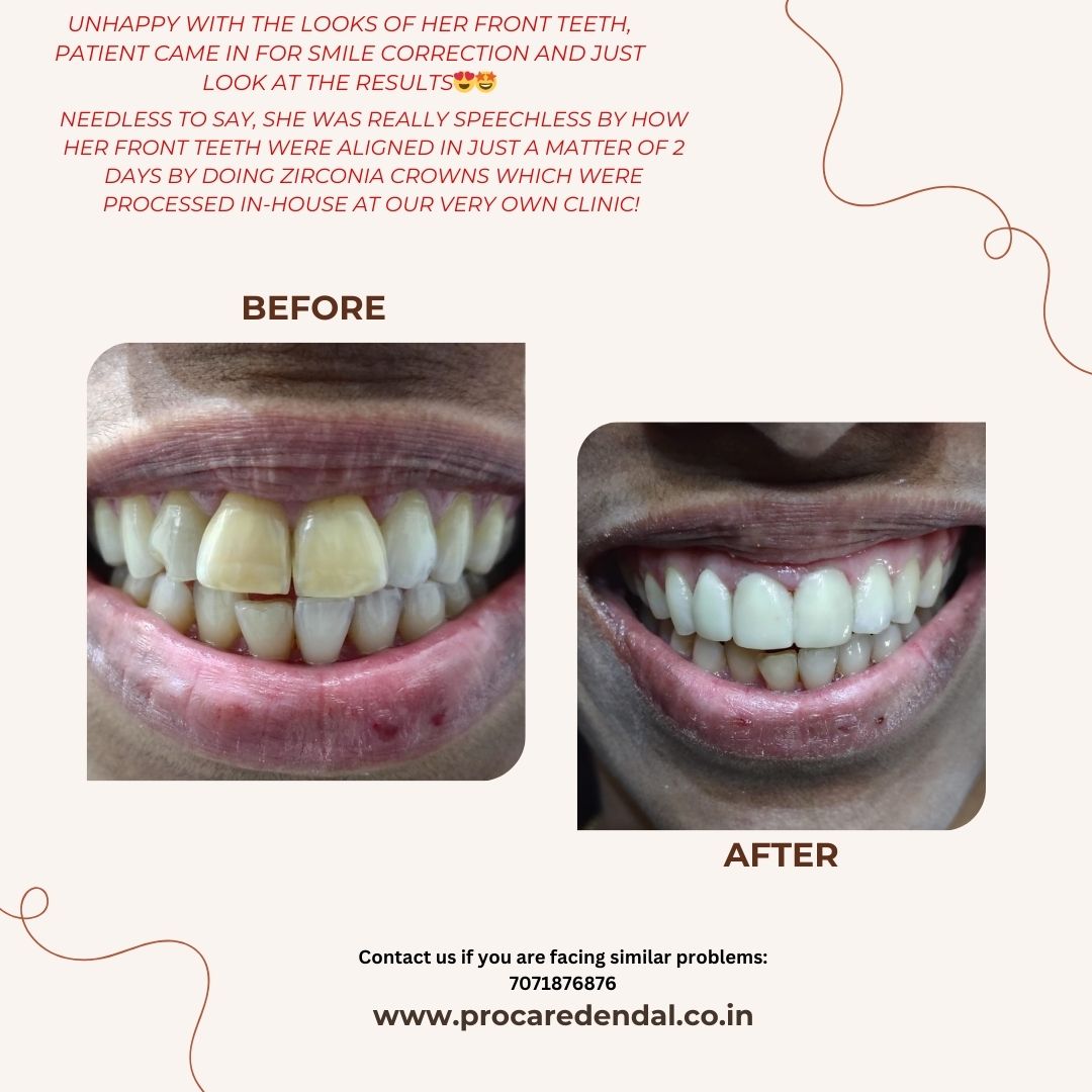 update image