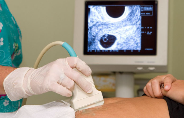 Ultrasound Services in Gurugram: Clear and Accu... main image