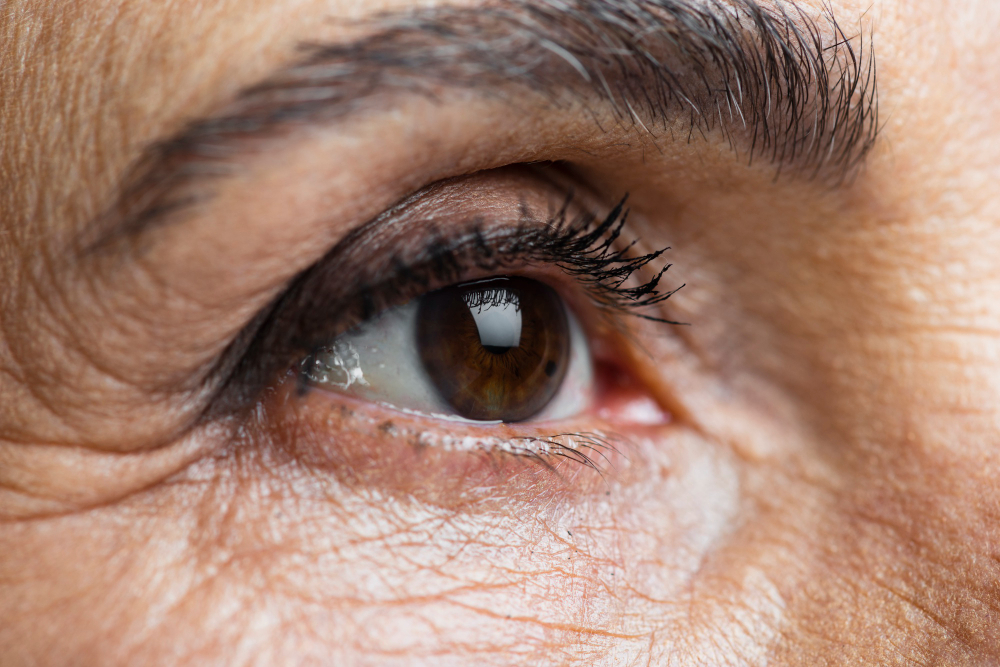 Cataract: Restoring Clarity with Cataract Surge... main image