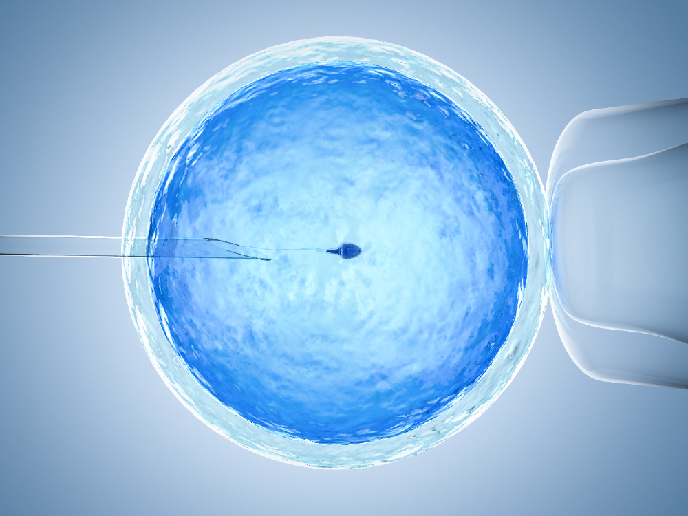 Best IVF Clinic in Chennai – Your Path to Paren... main image