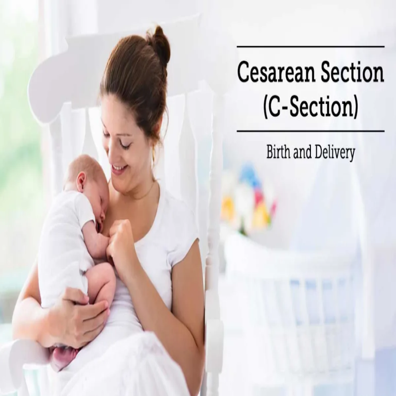 Cesarean Delivery in Nagpur: Safe and Compassio... main image