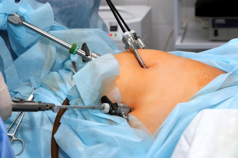 Expert Laparoscopic Hysterectomy in Chennai for... main image