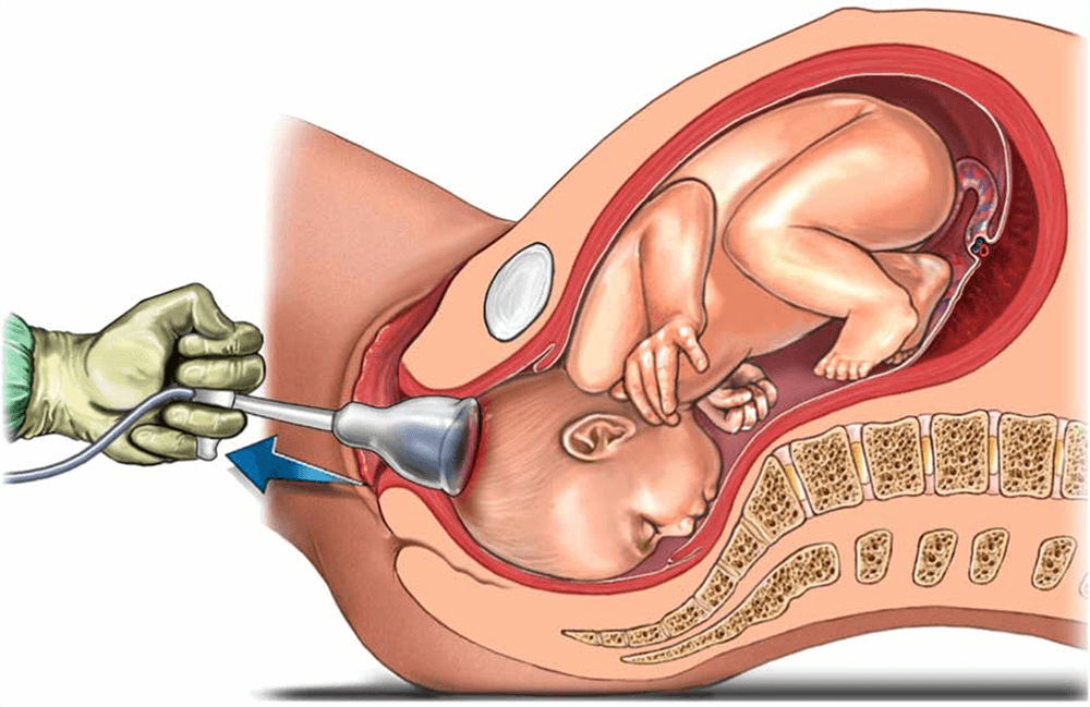 Assisted Delivery in Nagpur: Expert Support Whe... main image