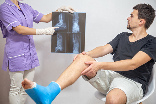 Best Surgery for Bone Fractures in Chennai: Adv... main image