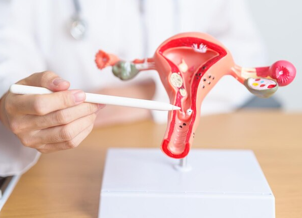 Laparoscopic Ovarian Drilling for PCOS Treatmen... main image