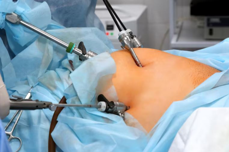 Laparoscopy Clinic in Adambakkam – Minimally In... main image