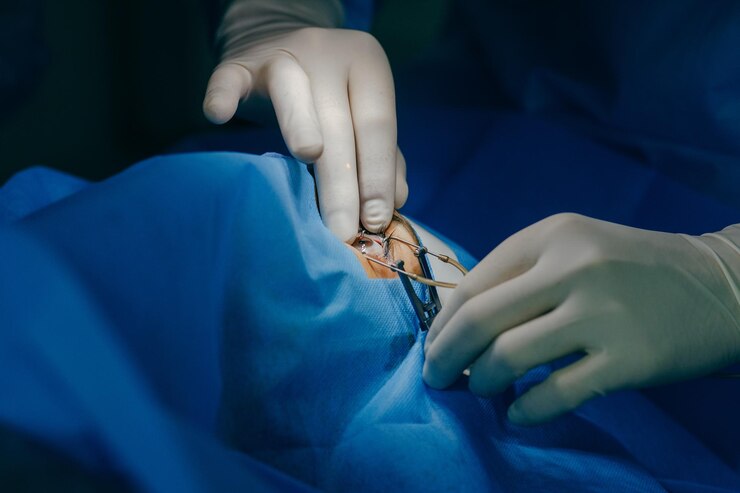 Cataract Lens Implant Surgery in Bannerghatta R... main image