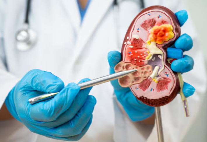 Nephrology in Pune – Specialised Kidney Care and T... main image