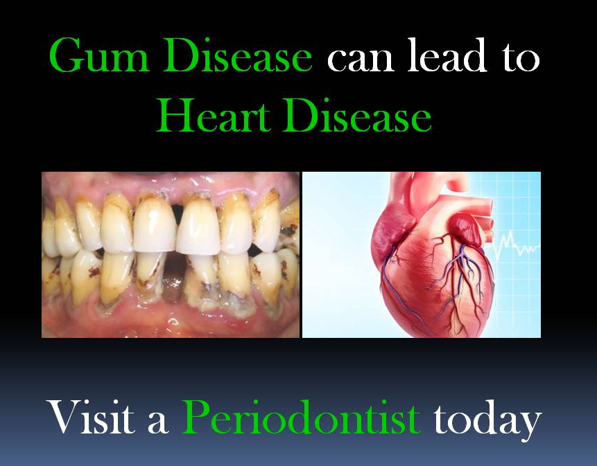 Periodontist Day
Gum disease leads to heart dis... main image