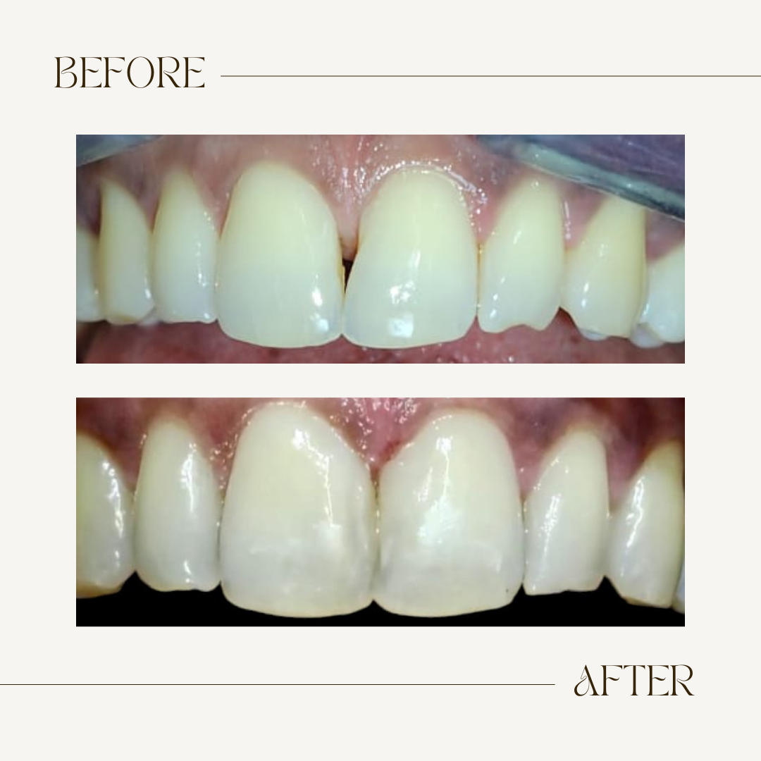 update image