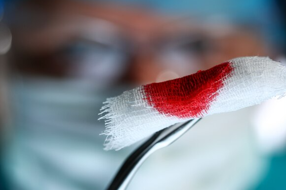 Bleeding Disorder Treatment by Experts in Chenn... main image