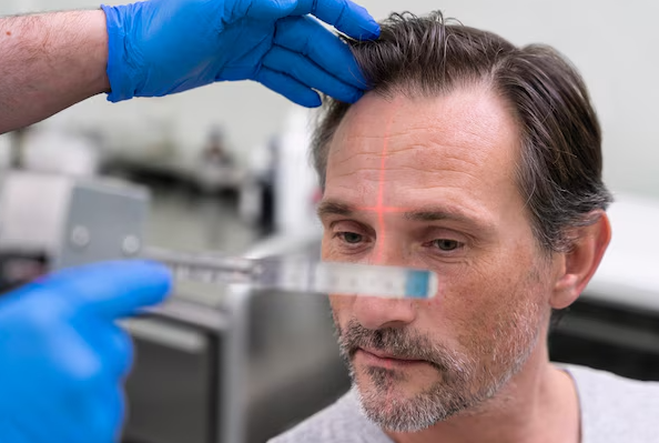 Hair Loss and Balding Treatment in MRC Nagar – Reg... main image