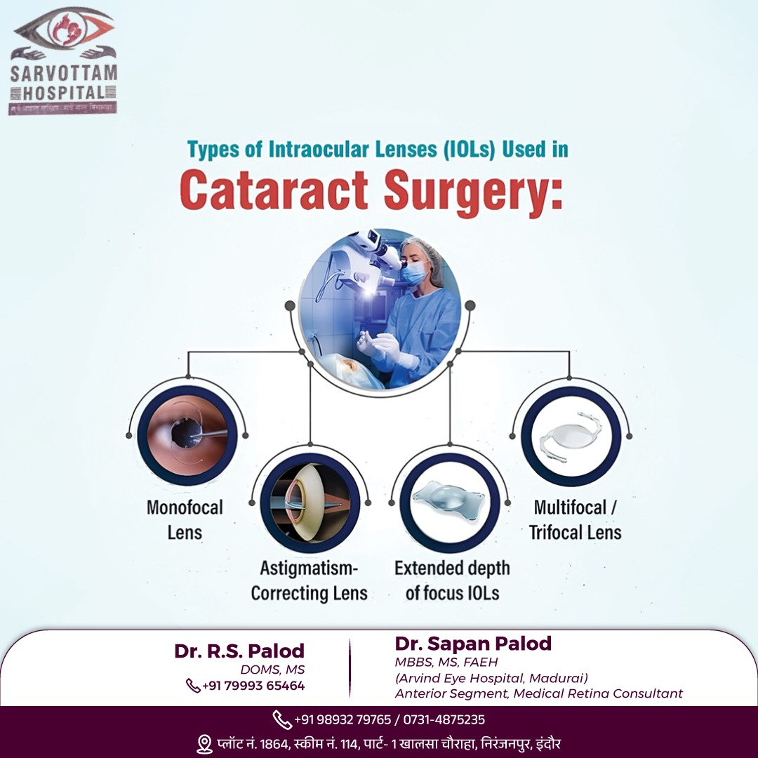 In cataract surgery, several types of intraocul... main image