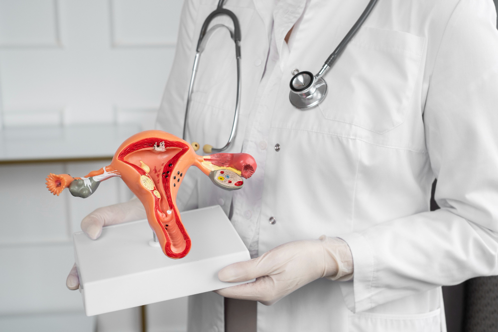 PCOS Treatment in Chennai – Regaining Hormonal ... main image