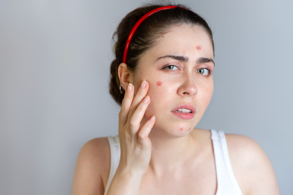 Skin Problems Treatment in RA Puram – Achieve Heal... main image