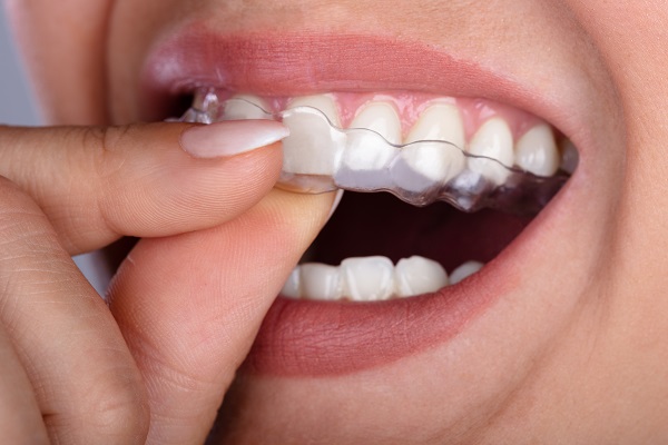 Expert Pediatric Dentist in Nashik – Painless &... main image