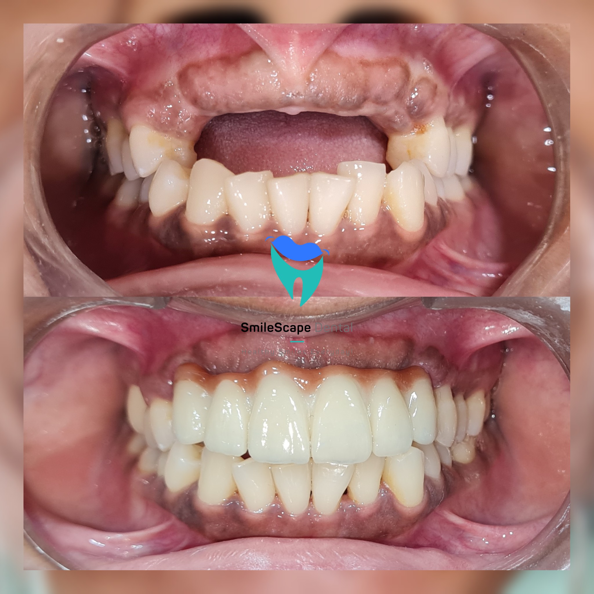 Each and every tooth in the mouth plays an impo... main image