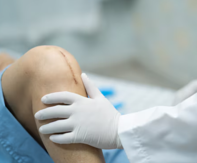 Joint Replacement Surgery in New Delhi: Restore... main image
