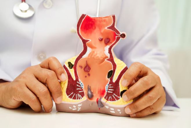 Proctologist in Tharamani – Specialised Care fo... main image