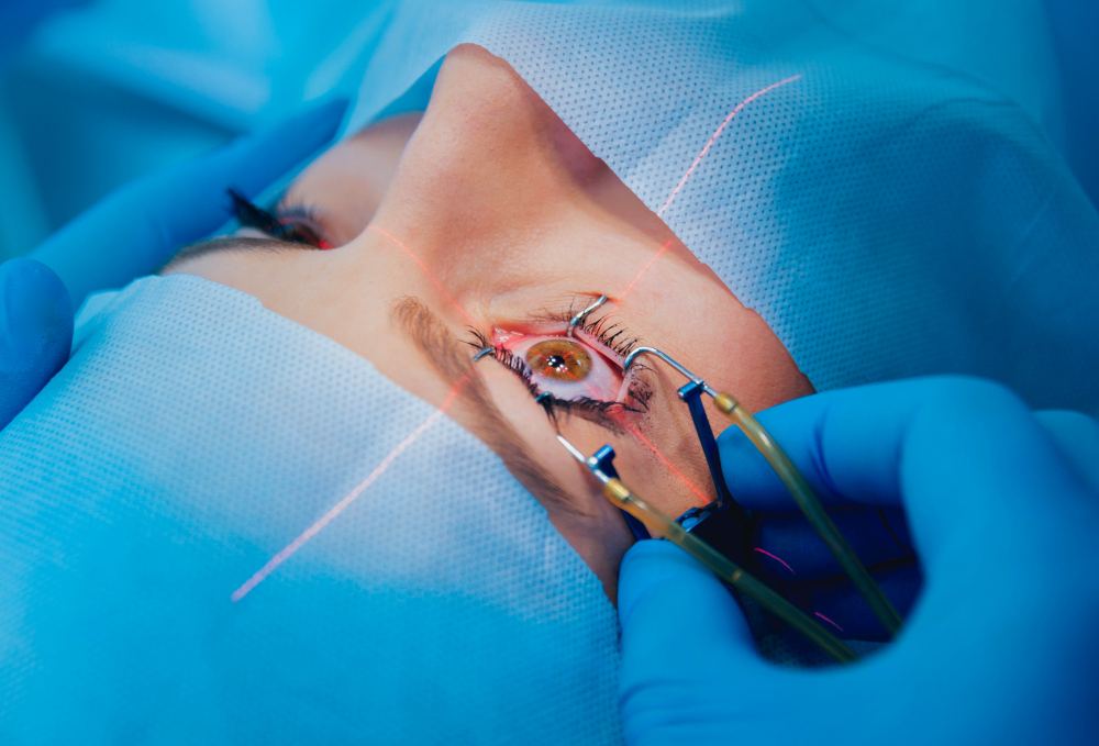 Cataract Surgery in Nagpur – Restore Your Visio... main image