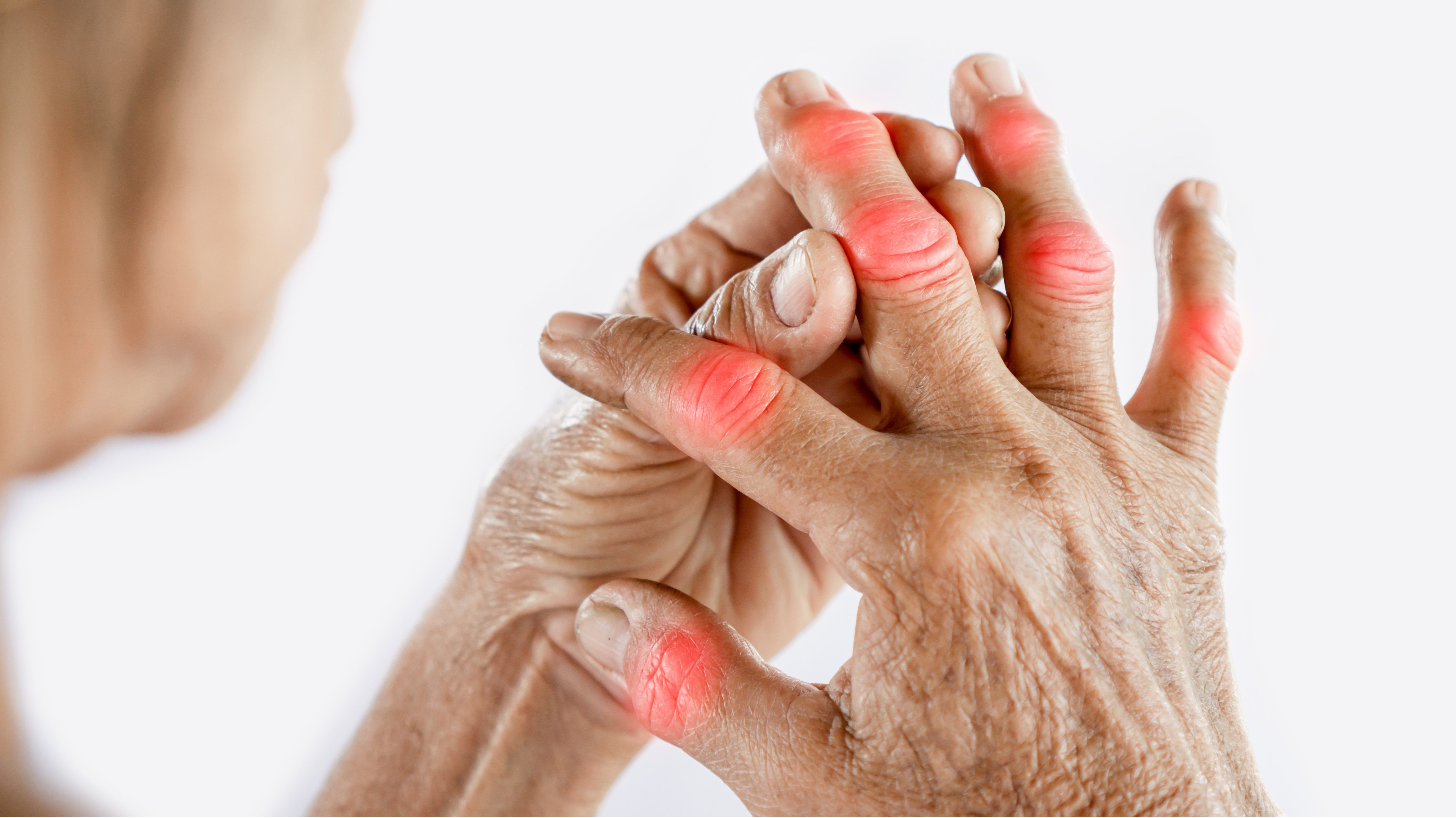 Arthritis and Autoimmune Arthritis Treatment in... main image