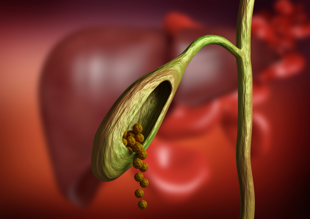 Gallbladder/Gallstone Treatment Hospital in Pun... main image