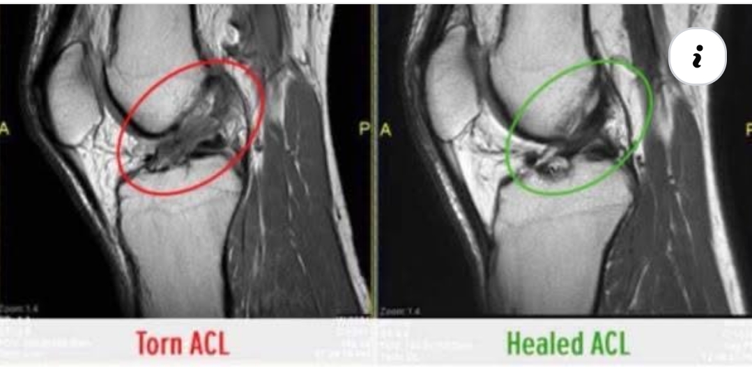 Physiotherapy clinic in Tambaram<br>Are you Lookin... main image