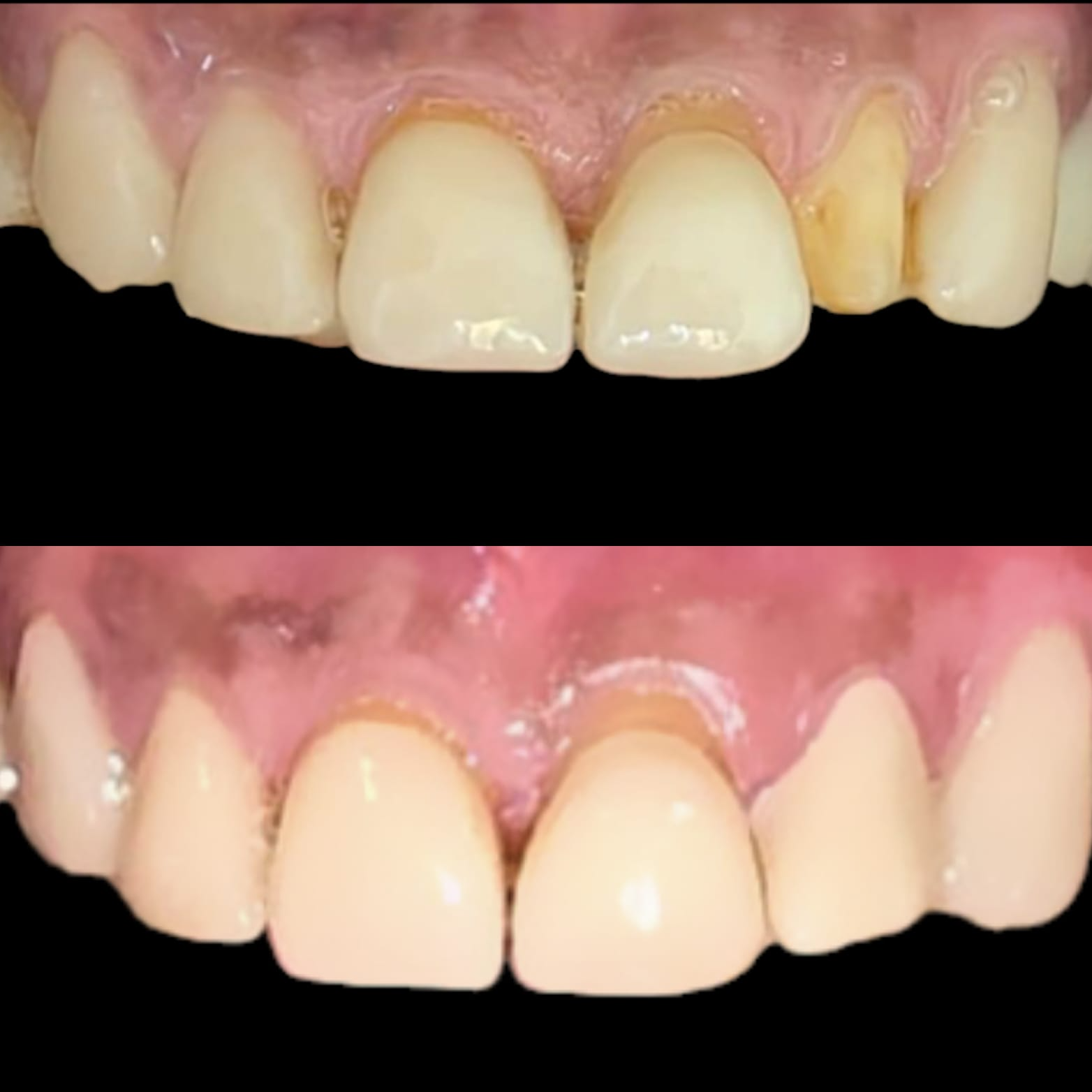 update image