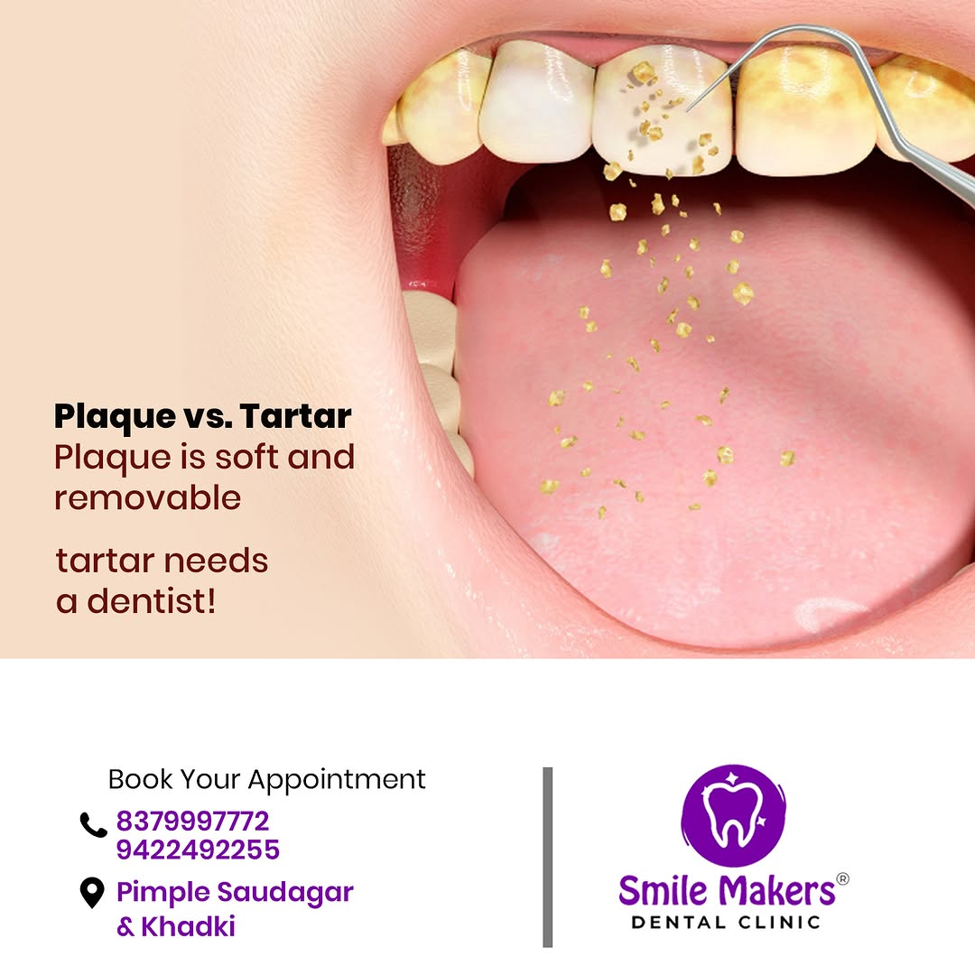 Best teeth whitening and cleaning in pimple saudag... main image