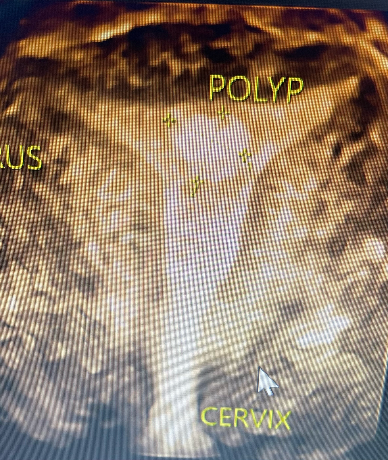 3D Pelvic Sonography  main image