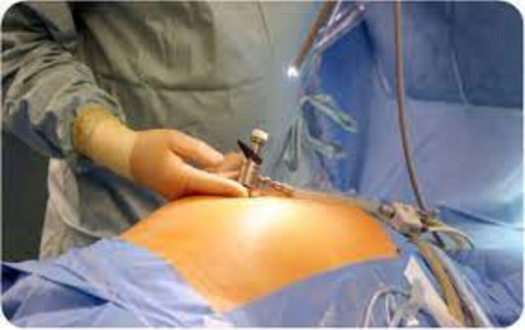Gynaecological Surgeries in Nagpur – Advanced C... main image