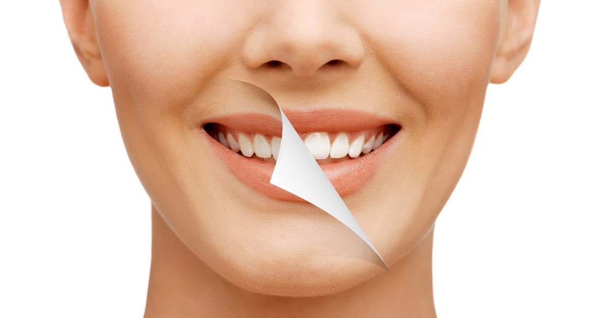 Get a beautiful and confident smile makeover in Na... main image