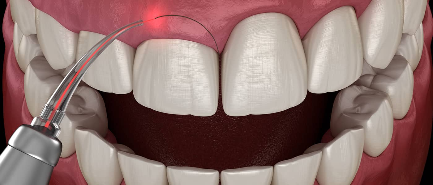 Get specialized gum disease treatment in Nashik... main image