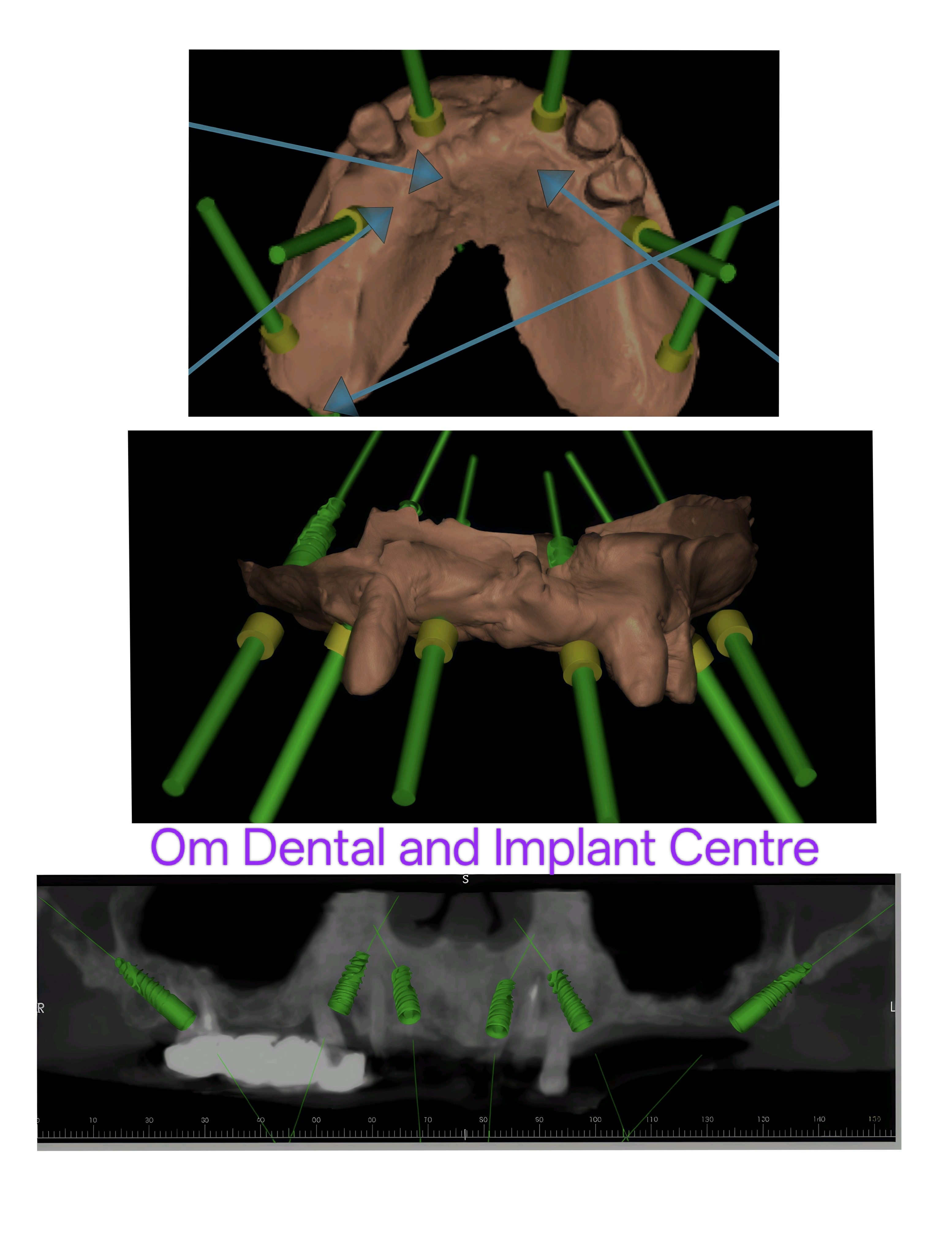 Digital Dental Implantology With advancing digi... main image