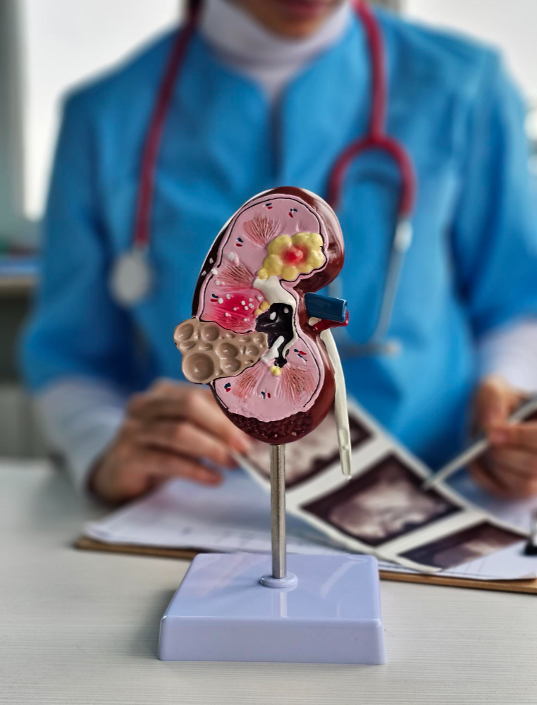 Expert Nephrology Care for Kidney Health in Che... main image