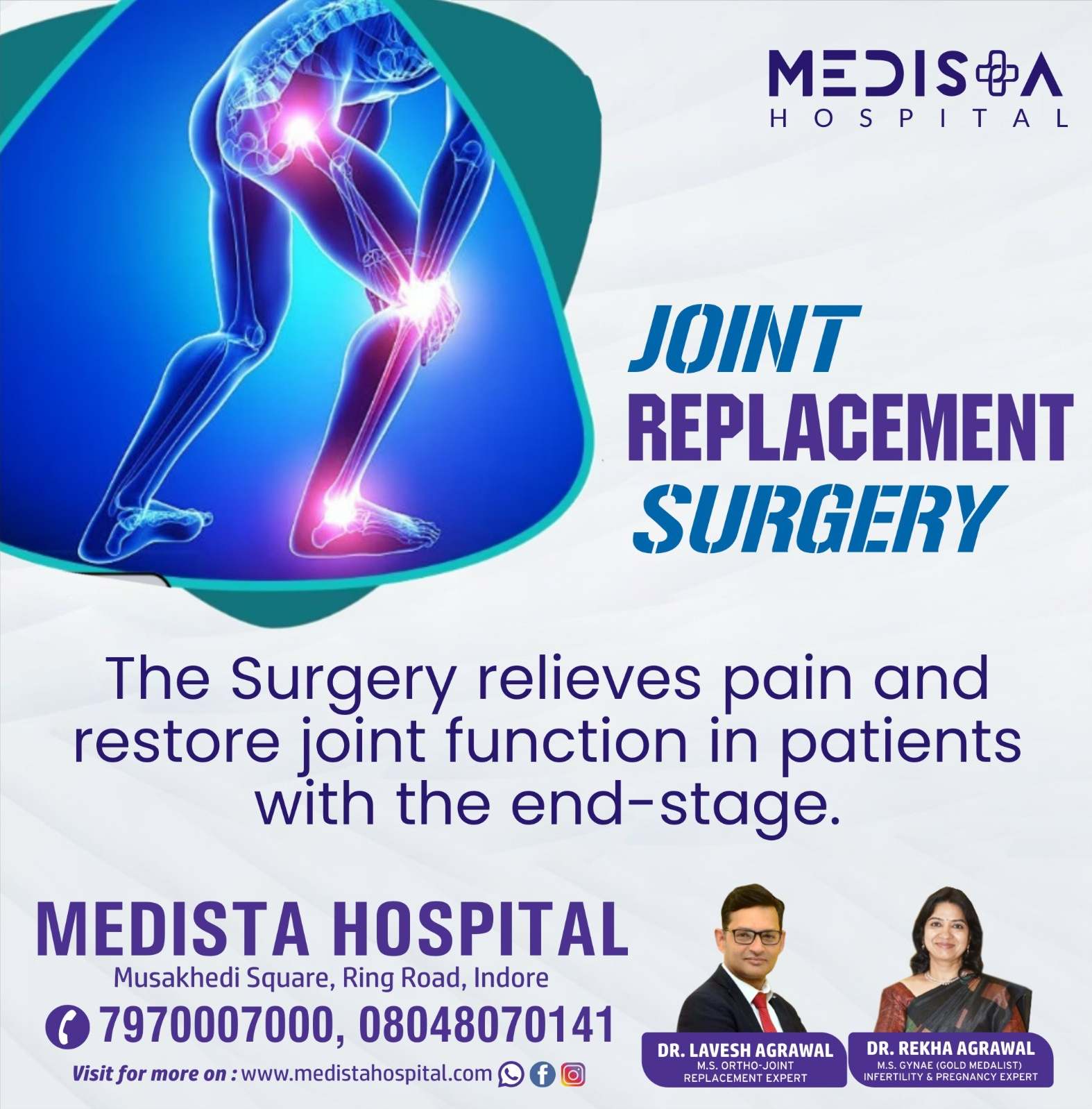 Best Joint Replacement Surgery in Indore!

Medista... main image