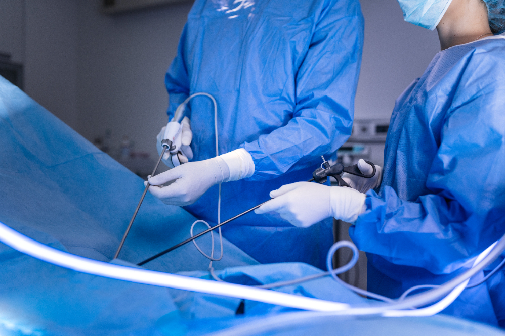 Laparoscopic Ovarian Drilling in Chennai – Effe... main image