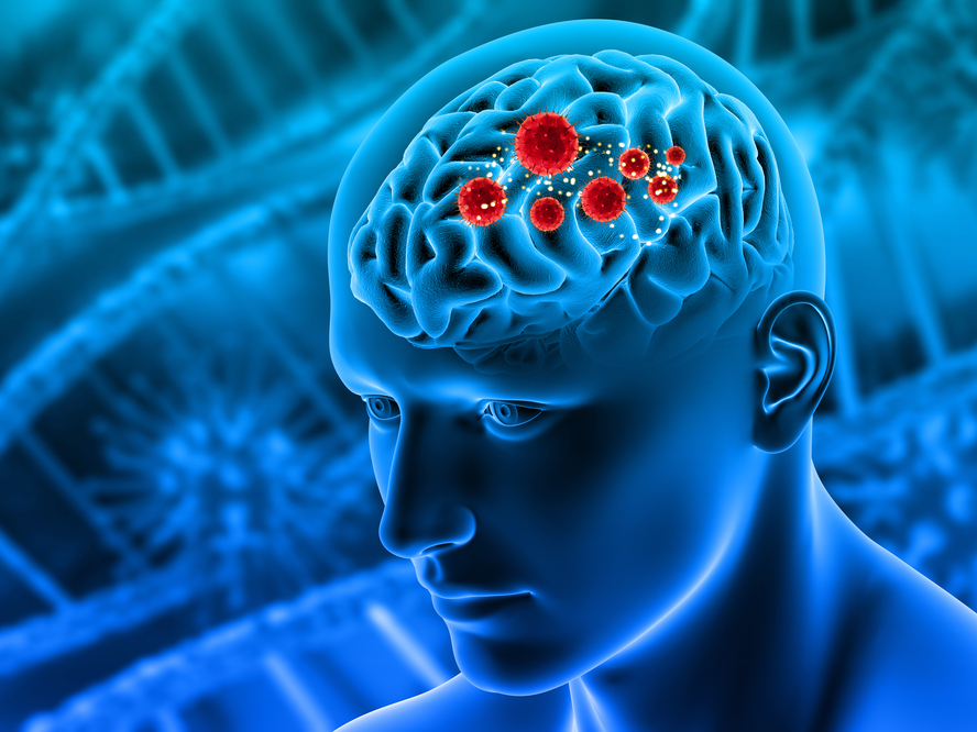 Best Surgeon for Brain Aneurysm in Jaipur: Expert ... main image