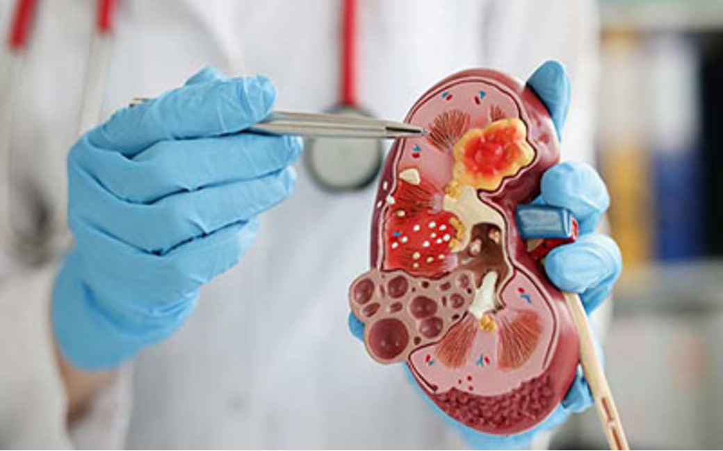 Trusted Nephrologist in Nagpur for Kidney-Relat... main image
