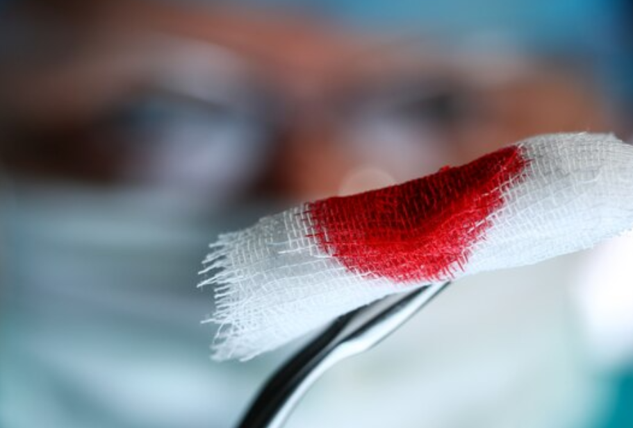 Bleeding Disorder Treatment in Chennai – Specia... main image
