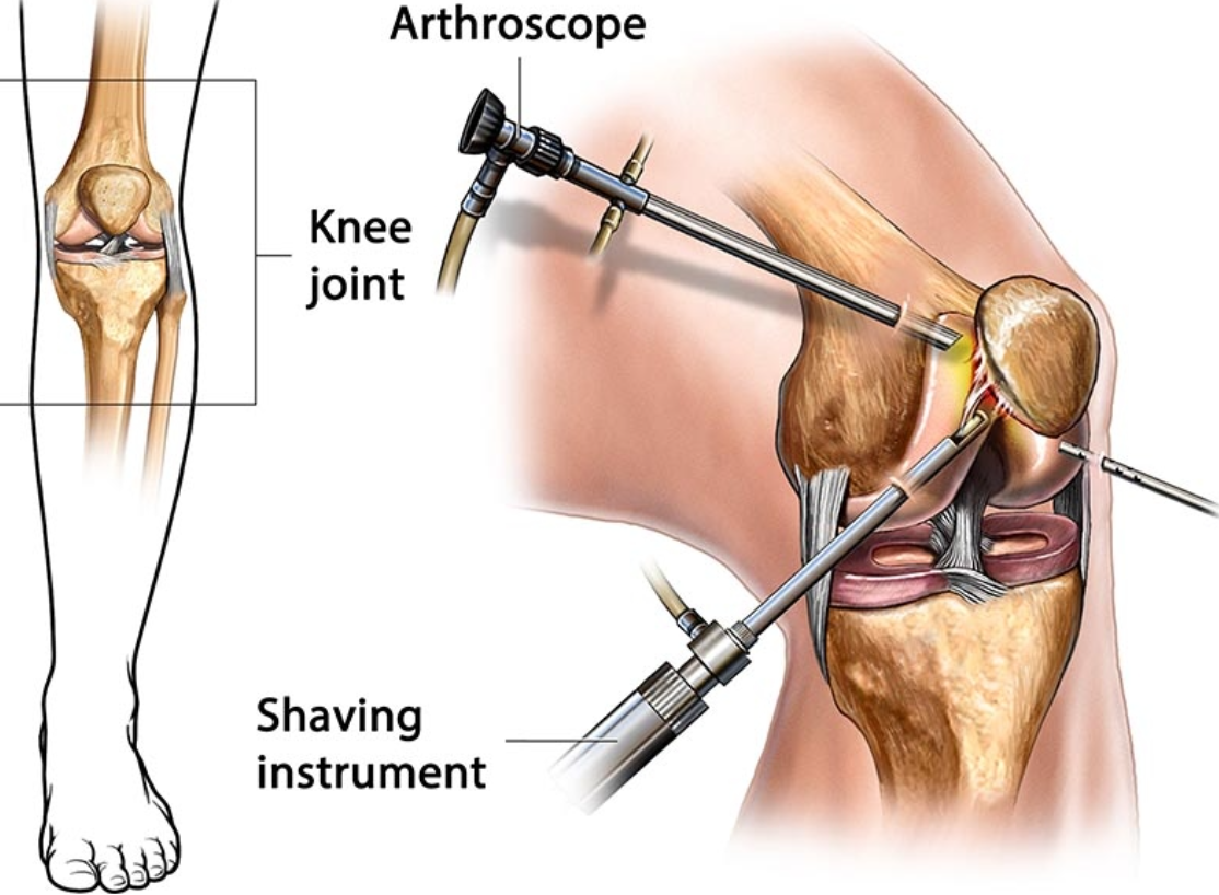 Best Arthroscopy and Sports Medicine in Pimpri ... main image