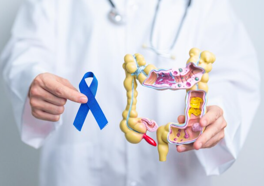 Robotic Colon Cancer Surgery: Expert Care in Nelam... main image