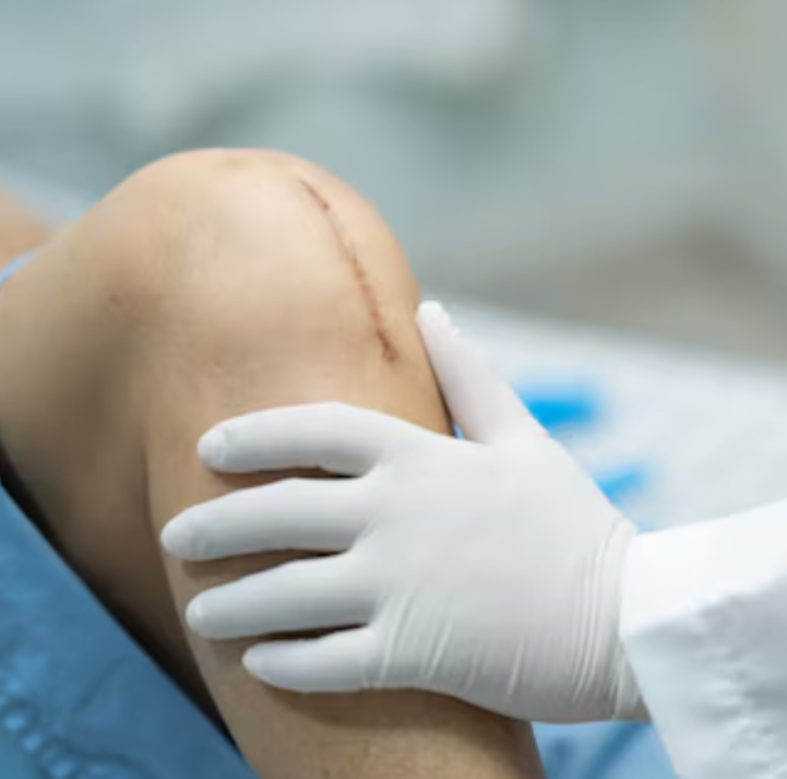 Best Joint Replacement Treatment in New Delhi J... main image