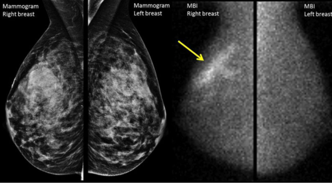 Mammography Services